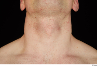 Torin neck 0001.jpg